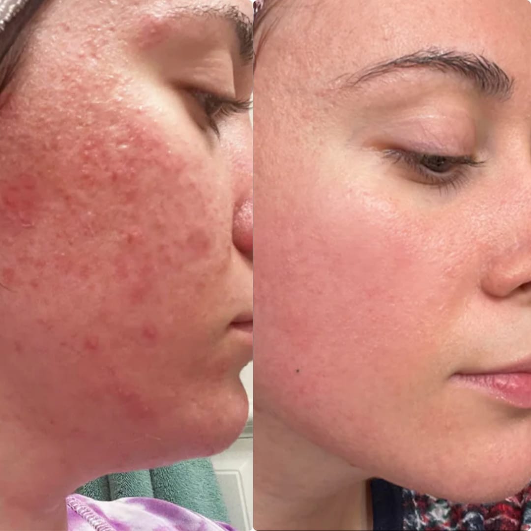 LUMINORA Rice Peel Shot | Siero Esfoliante al Riso Nero e Bianco