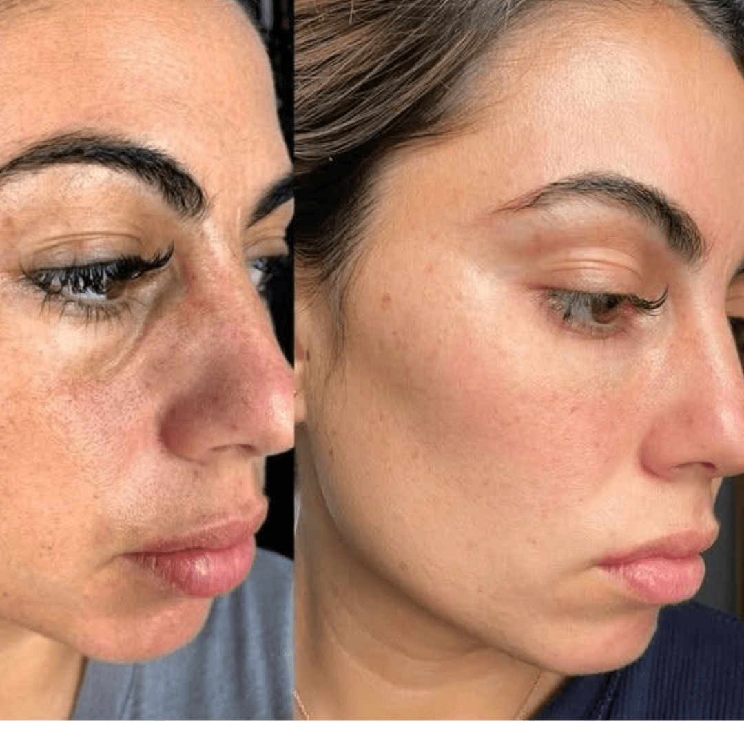 LUMINORA Rice Peel Shot | Siero Esfoliante al Riso Nero e Bianco