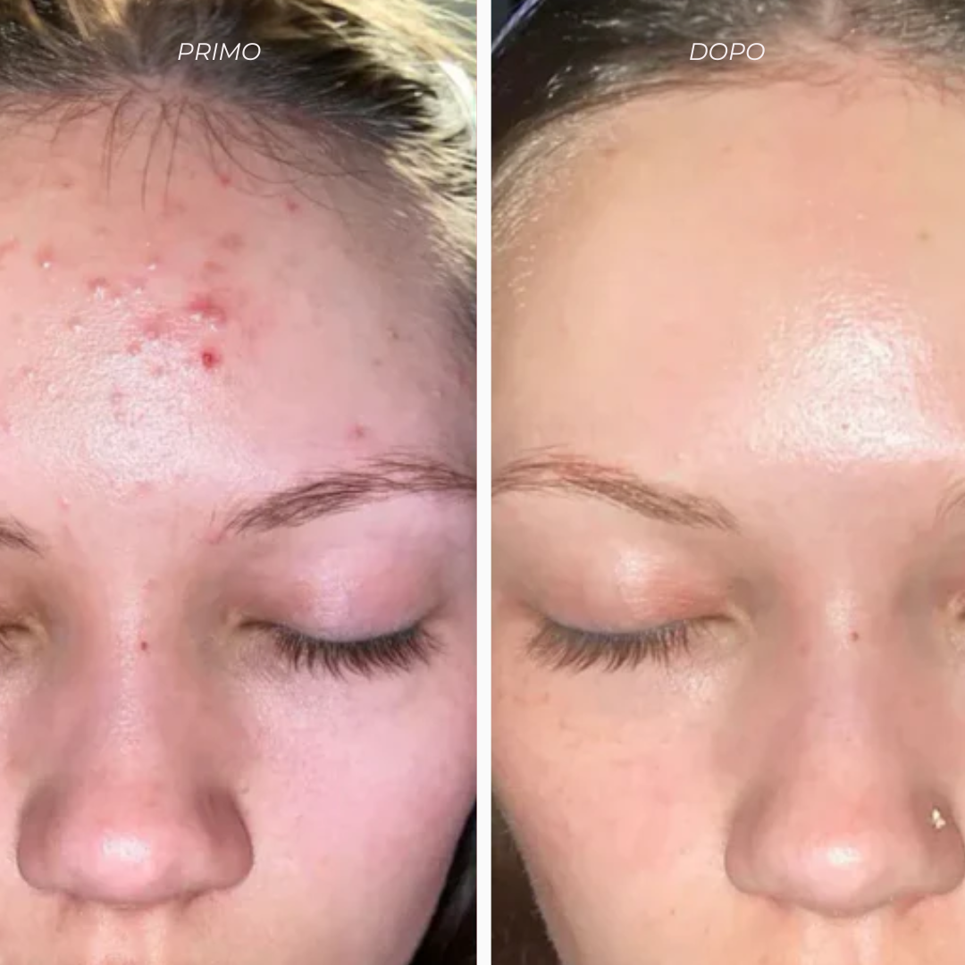 LUMINORA Rice Peel Shot | Siero Esfoliante al Riso Nero e Bianco