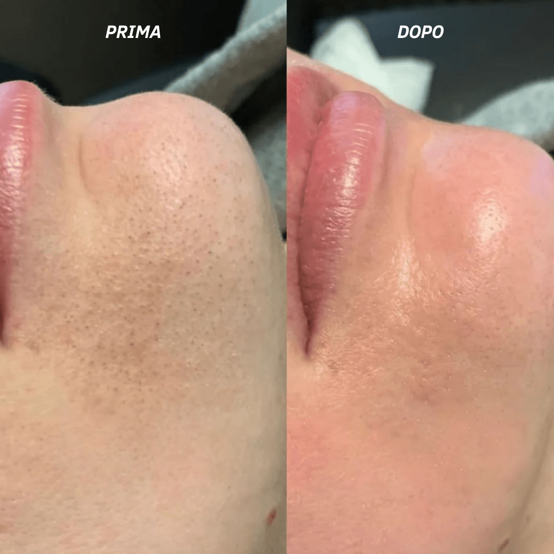 LUMINORA Rice Peel Shot | Siero Esfoliante al Riso Nero e Bianco